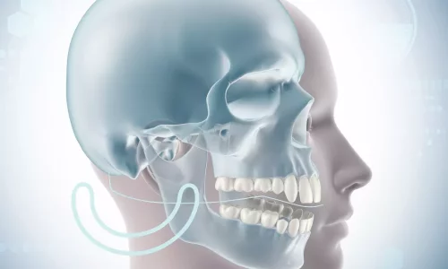 Can jaw narrowing cause crossbite? - Milim Dental Hospital