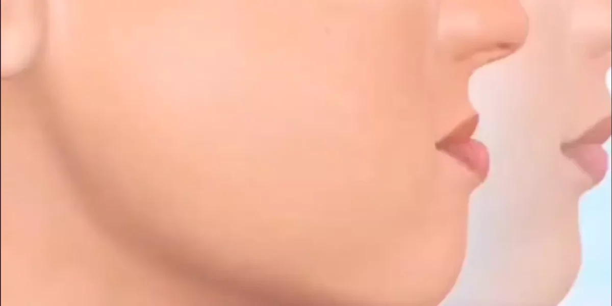 Poate fi corectată structura maxilarului prin ortodonție sau este necesară o intervenție chirurgicală?