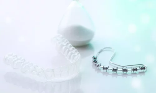 How long does orthodontic treatment usually take? - Milim Dental Hospital