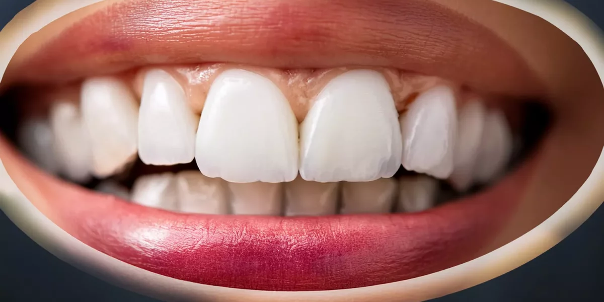 Cum Decizi Mărimea Dinților Mei?” O Explorare Detaliată a Digital Smile Design și Proporțiilor Dinților