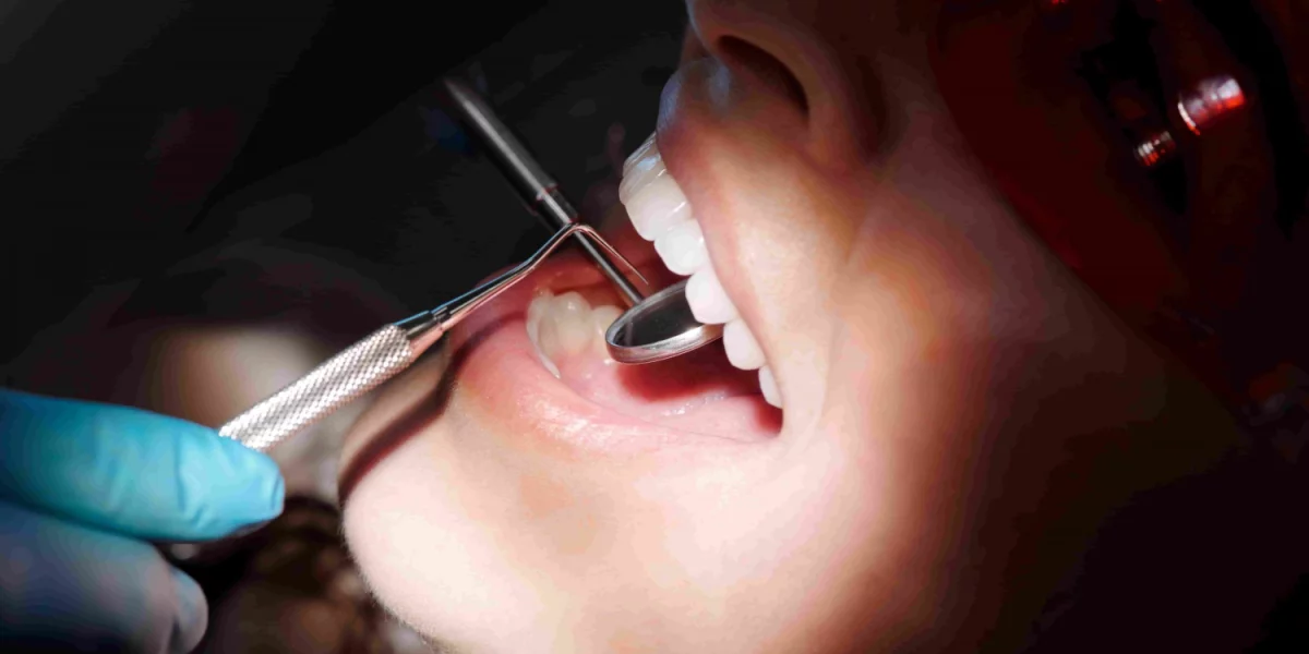 What Is a Dental Abscess and What Causes It?