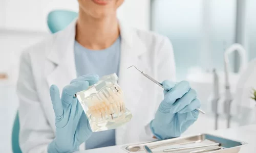 Are ceramic braces more fragile? - Milim Dental Hospital