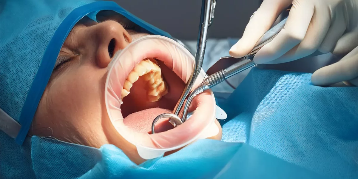 Extracția dinților la pacienții cu dizabilități intelectuale