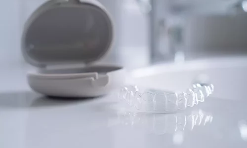 Are retainers included after Invisalign? - Milim Dental Hospital