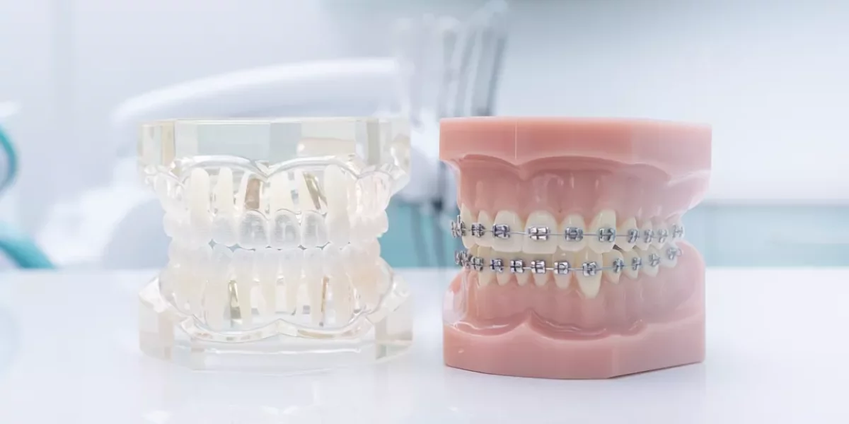 Can Invisalign fix crossbite or deep bite?