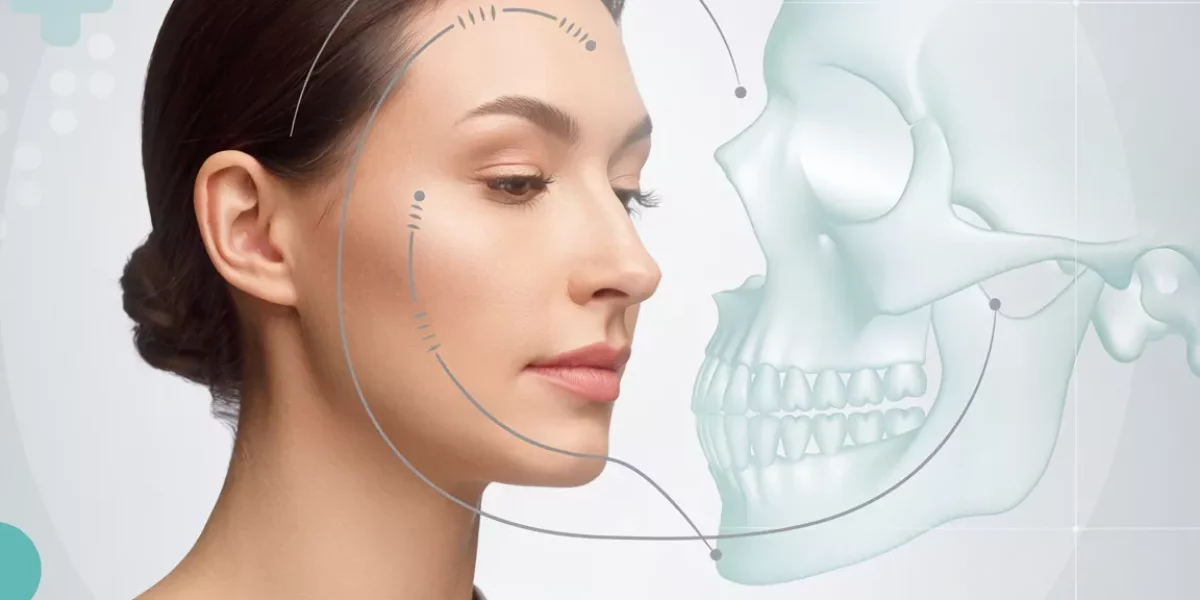 What are signs of jaw narrowing?