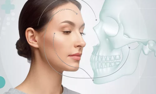 What are signs of jaw narrowing? - Milim Dental Hospital