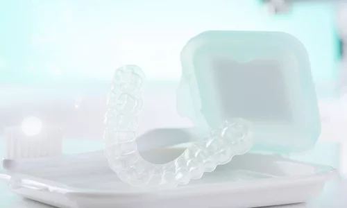 What retainer is used after treatment? - Milim Dental Hospital