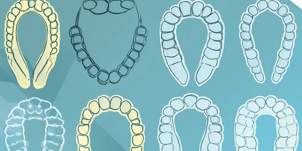 Are All Clear Aligner Brands the Same?