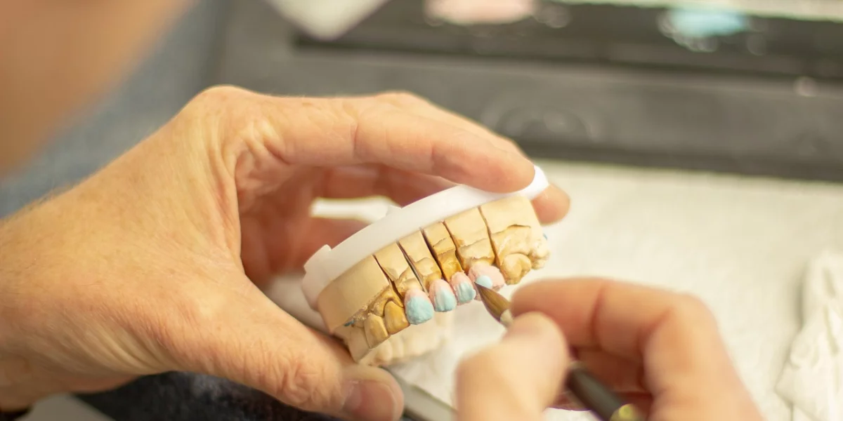 12 Things You Should Know About Dental Prosthetics
