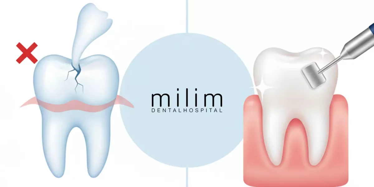 Curățarea tartrului este dăunătoare?
