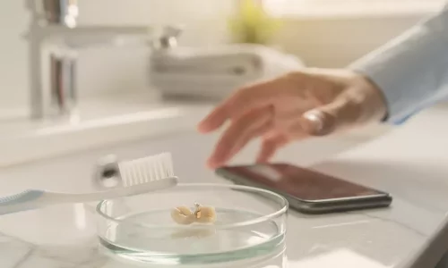 What to Do If a Veneer Chips After Returning Home - Milim Dental Hospital