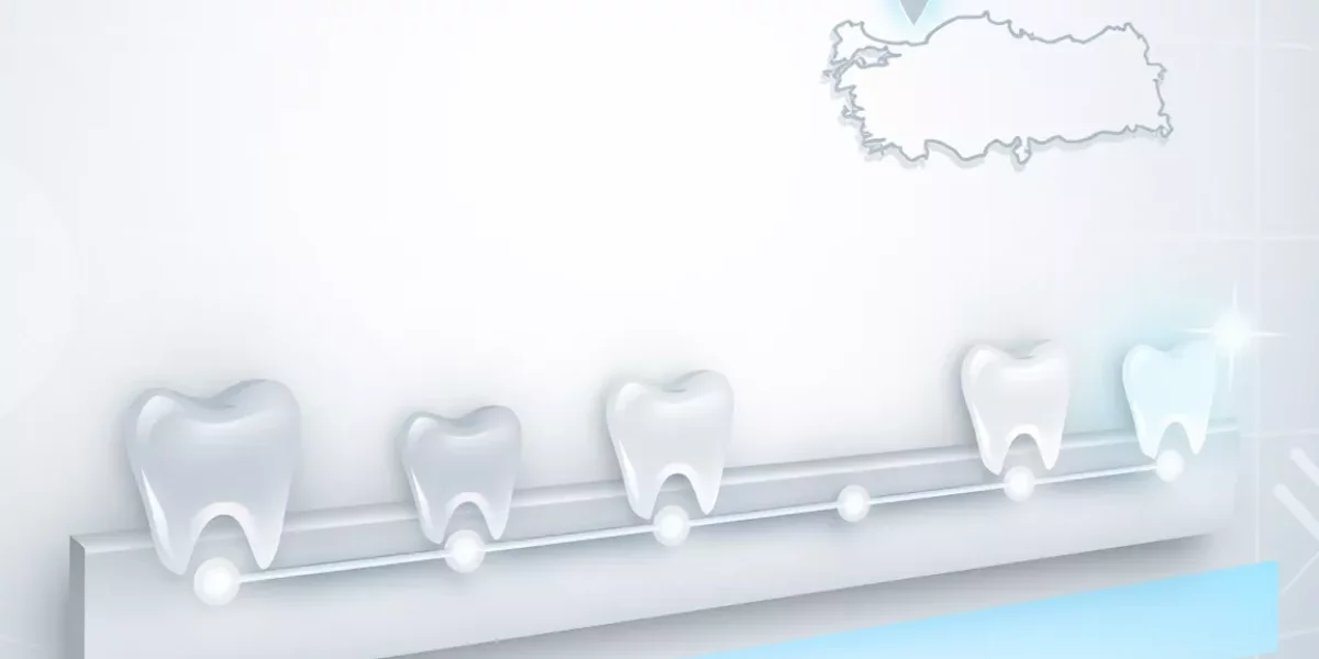 Veneers Turkey Timeline