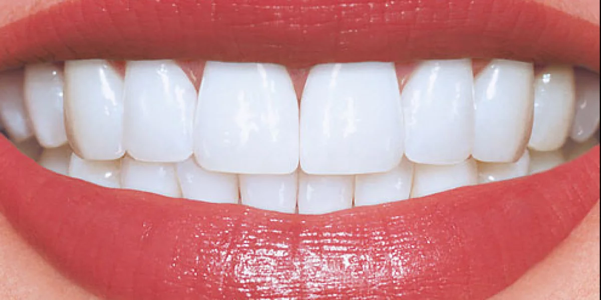 Everything You Need to Know About Zirconium Crowns