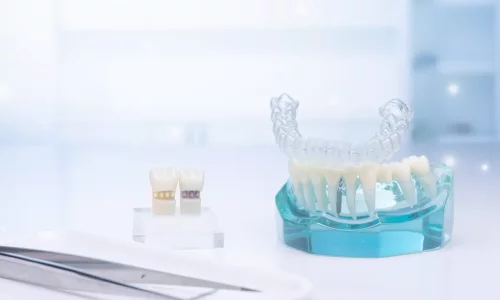 What role do attachments play? - Milim Dental Hospital