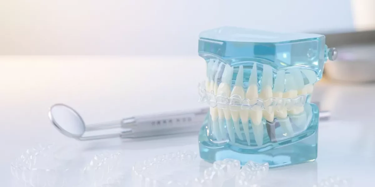 Are aligners suitable for moderate crowding?