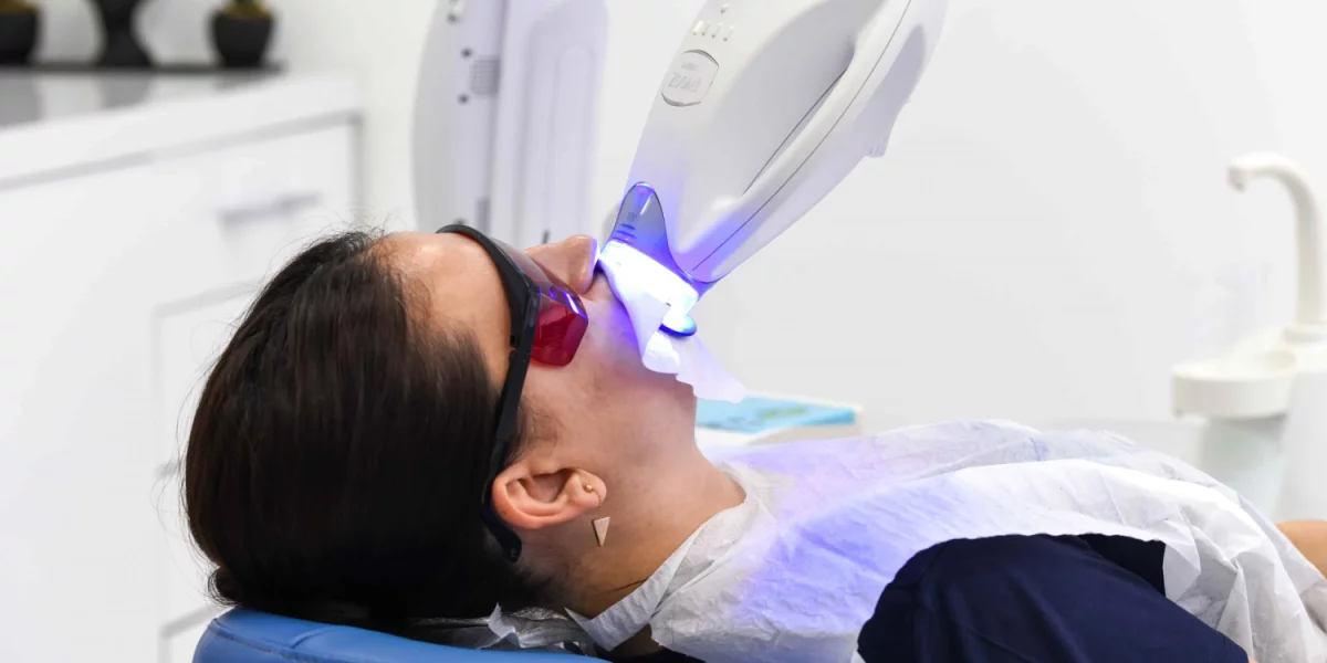 Ce este albirea dinților și de ce este necesară?