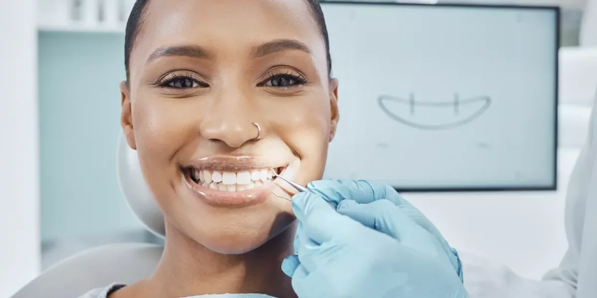 Gum Contouring + Smile Design: When It’s Needed (And When It’s Not)