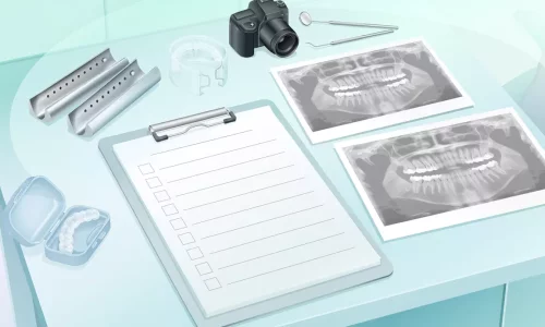 Ortho Consultation Checklist: What Records Are Needed and Why? - Milim Dental Hospital