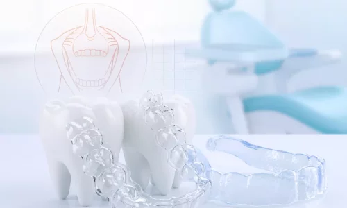 Teeth Grinding Orthodontics - Milim Dental Hospital