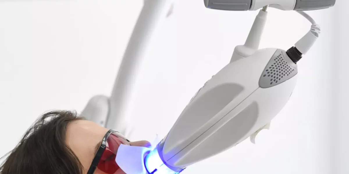 Albirea dinților în siguranță – Ce trebuie să știi înainte să-ți albești zâmbetul