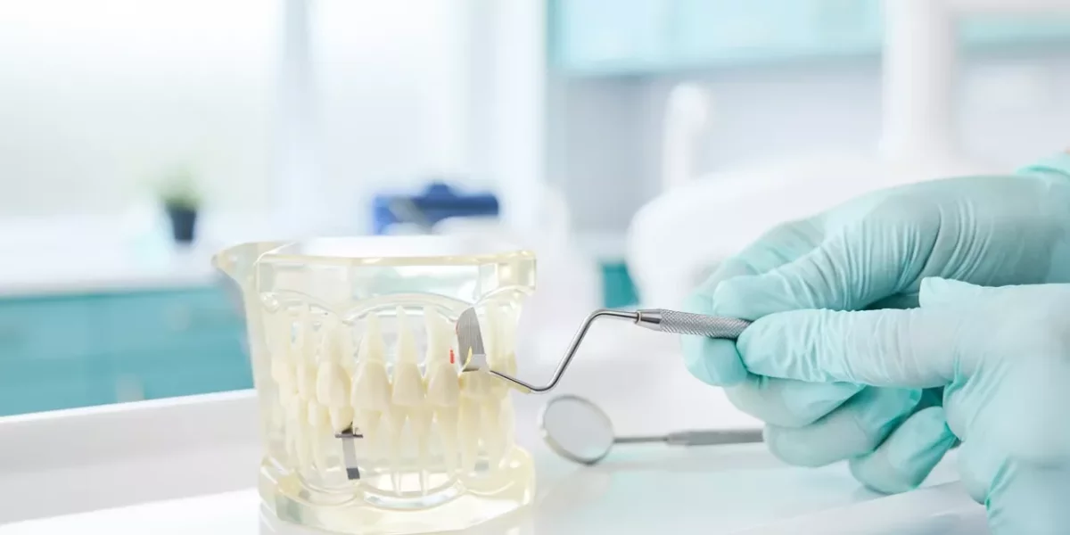 IPR (Interproximal Reduction): Is Teeth Shaving Necessary?