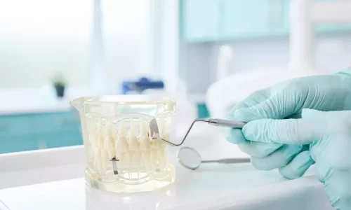 IPR (Interproximal Reduction): Is Teeth Shaving Necessary? - Milim Dental Hospital