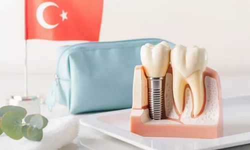Implant Aftercare Turkey Guide - Milim Dental Hospital