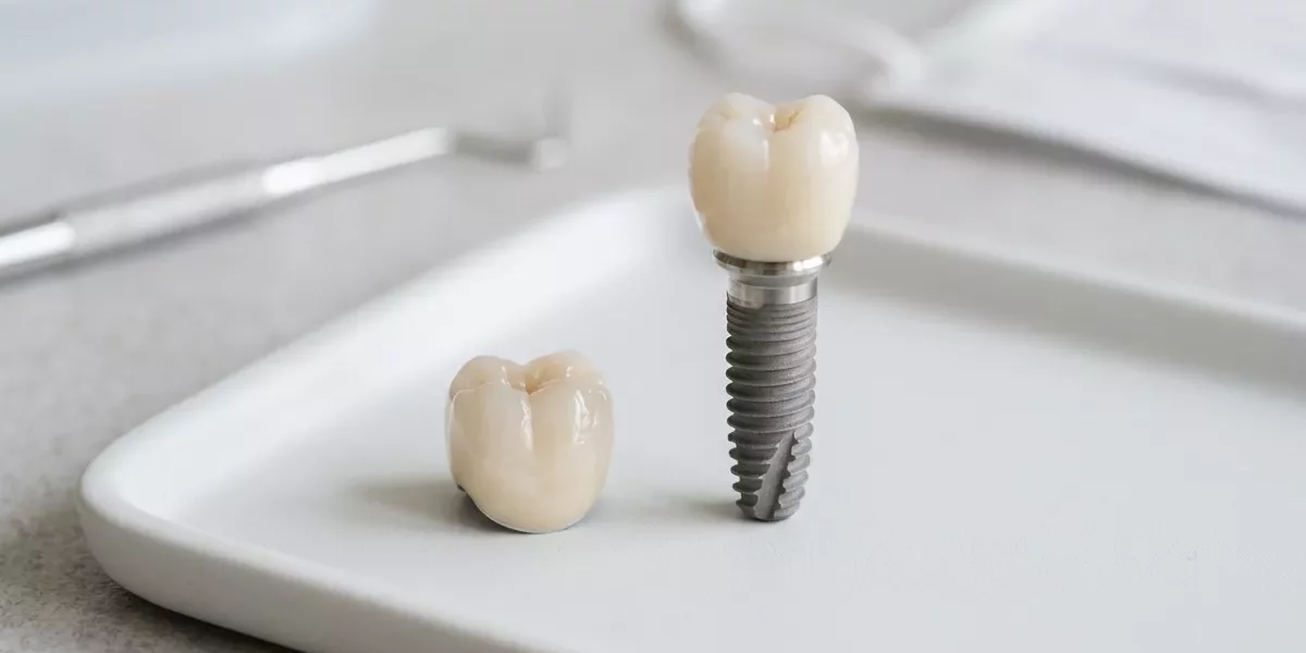 Dental Implant vs Crown: What Is the Difference and Which One Do You Need?