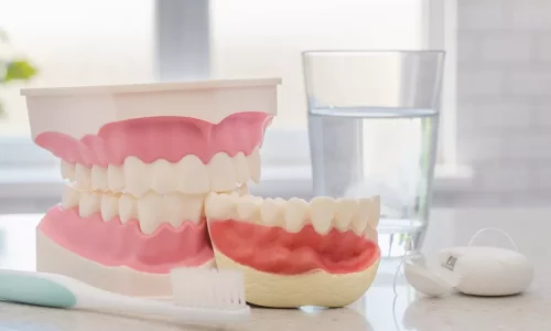 Gum Disease (Periodontal Disease): Early Signs You Shouldn’t Ignore - Milim Dental Hospital