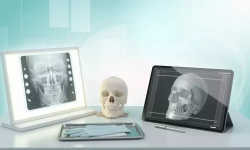 Do I need X-rays or digital scans? - Milim Dental Hospital