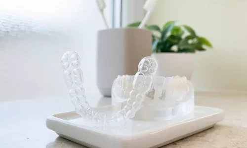 Bruxism (Clenching) + Orthodontics: Can You Still Do Invisalign? - Milim Dental Hospital