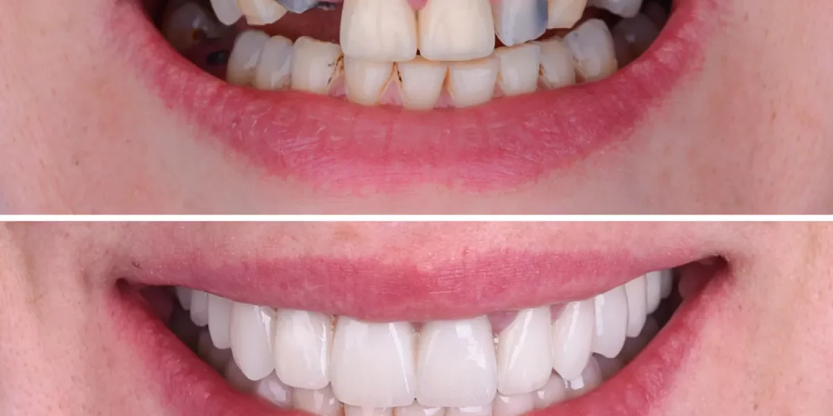 Can a Better Smile Really Change Daily Life?