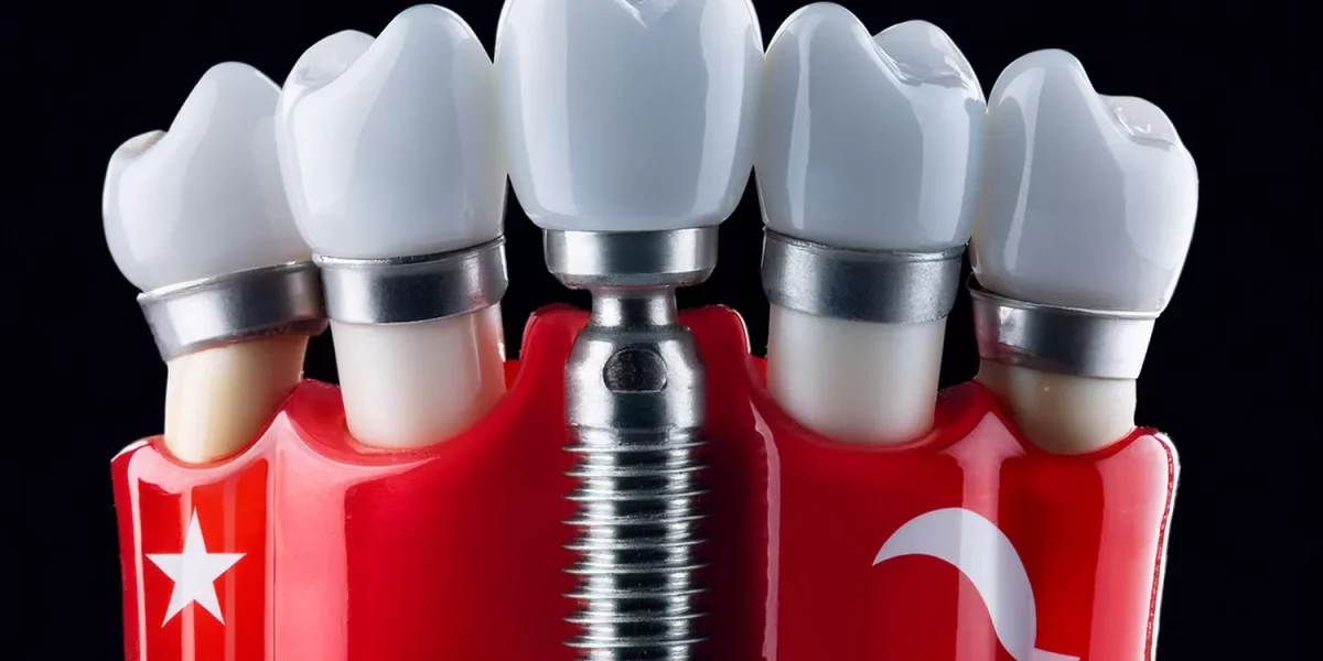 Implanturi dentare în Turcia: Cât durează cu adevărat întregul proces?
