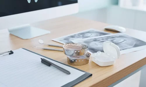Ortho Consultation Checklist: What Records Are Needed and Why? - Milim Dental Hospital