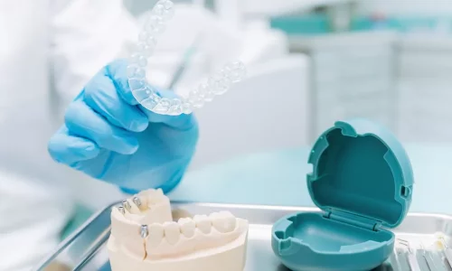 How do refinements work? - Milim Dental Hospital