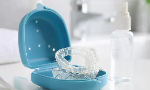 What retainer is used after treatment? - Milim Dental Hospital