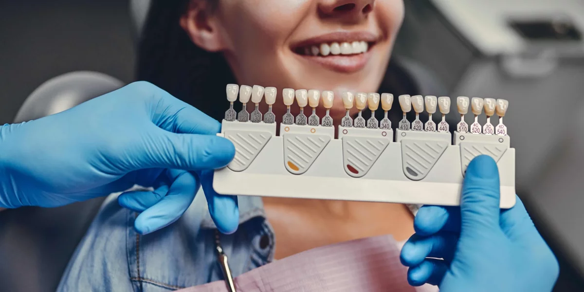 Beneficiile fațetelor dentare: de ce să le alegi pentru transformarea zâmbetului tău