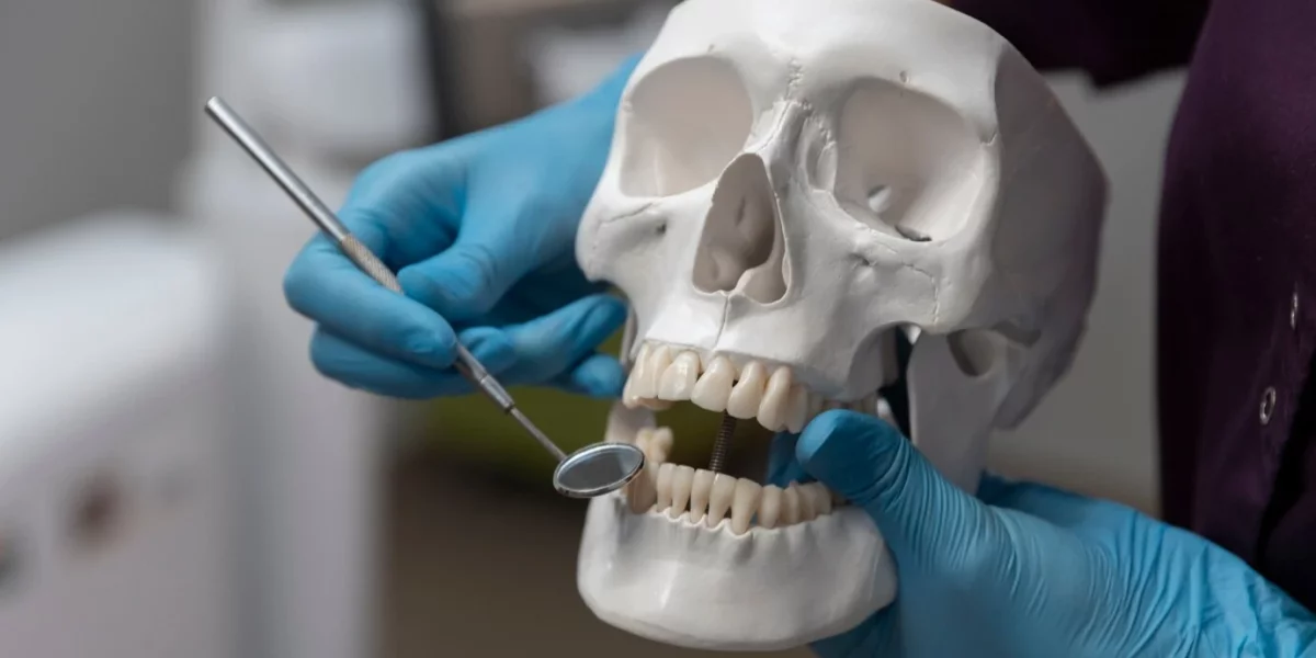 Implanturi zigomatice vs. implanturi tradiționale: Care este cel mai bun?