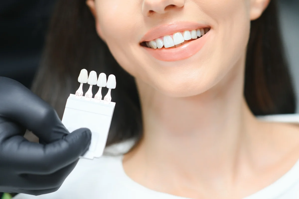 Are Veneers Right for You? How to Determine If You’re a Candidate