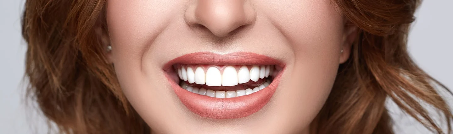 Why Getting a Hollywood Smile in Turkey is the Smartest Investment for Your Confidence